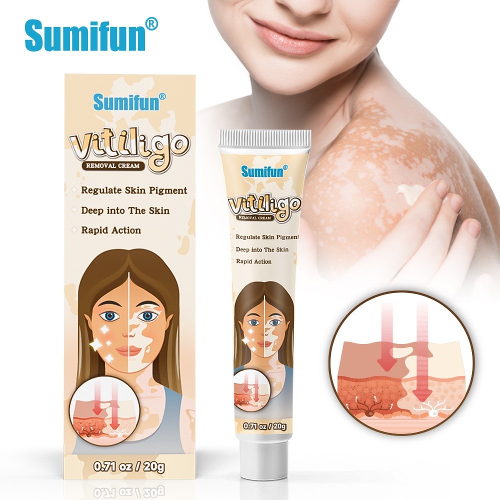 Sumifun Vitiligo Removal Cream 20gm