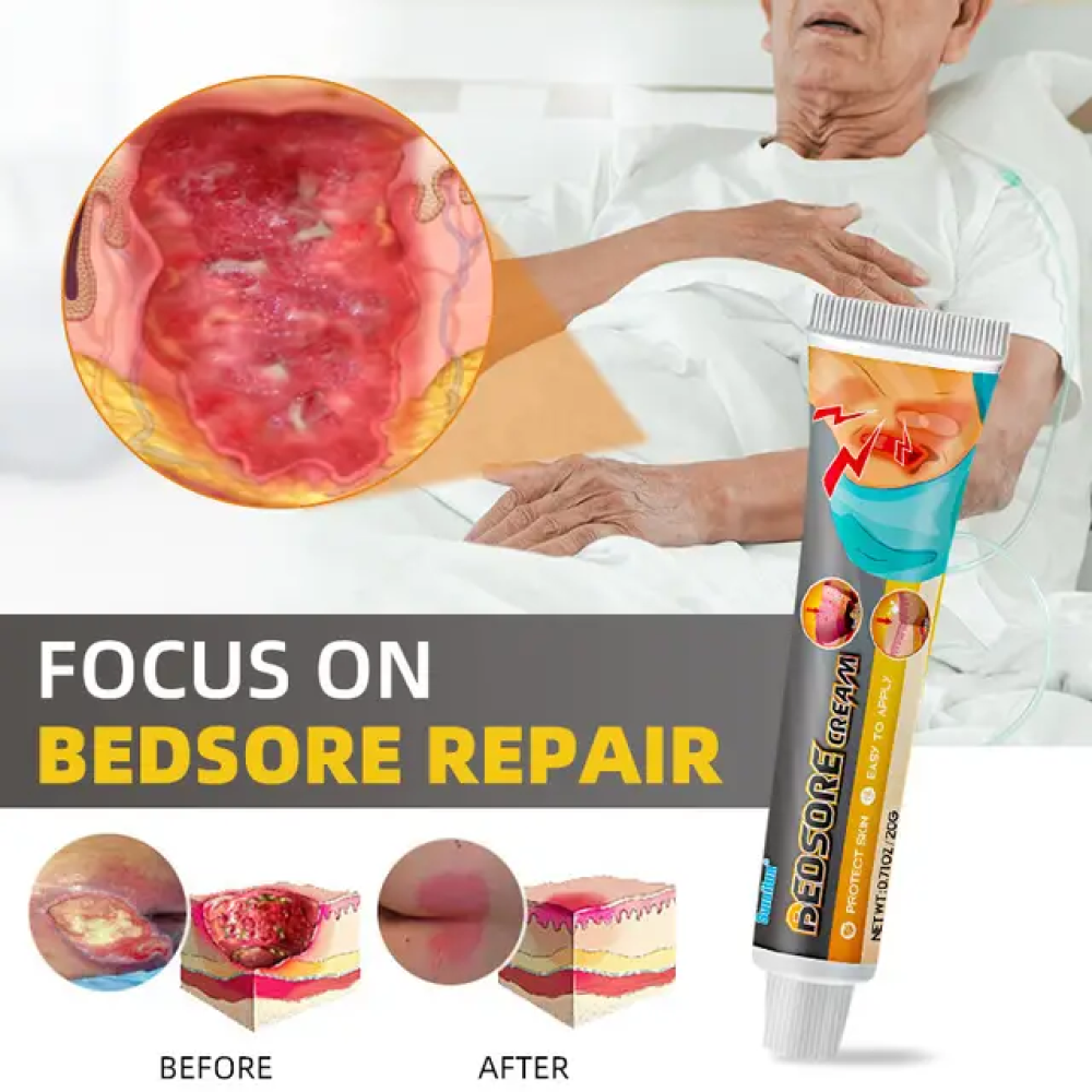 Sumifun Bed sores Treatment Cream Remove Rot Necrotic Tissue Treat Sores Ulcer Wound Healing Ointment Anti-lnfection